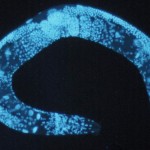 Enlarged_c_elegans